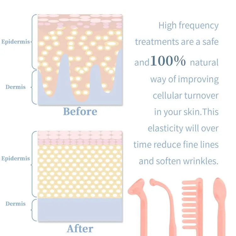 Terapia de pele portátil de alta frequência